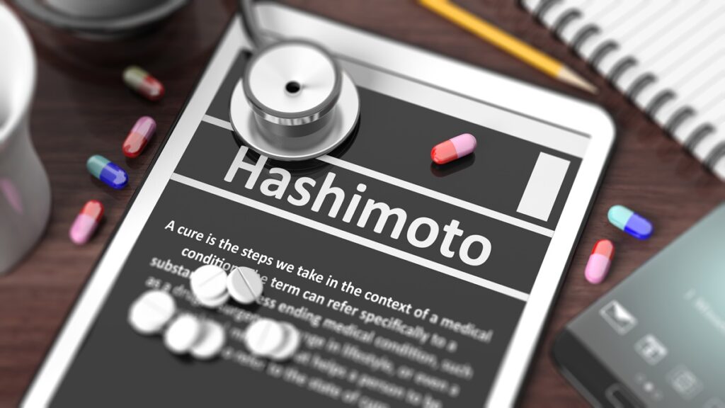 hashimoto a planowanie ciąży