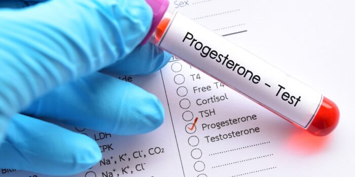 progesteron badanie