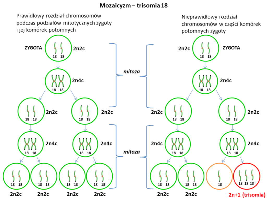 mozaicyzm trisomia 18