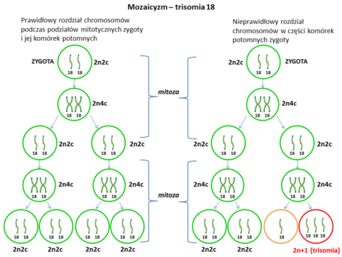 trisomia-18-zesp-edwardsa-centrum-medyczne-meavita-krak-w
