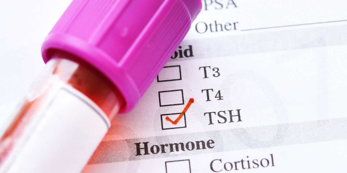 TSH - hormon tyreotropowy