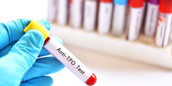 anty-TPO - przeciwciała przeciwko peroksydazie tarczycy