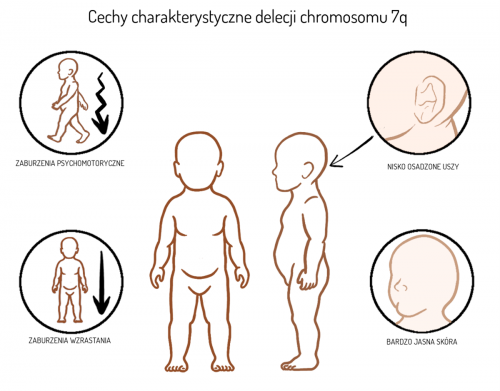 Delecja chromosomu 7q - Centrum Medyczne Meavita | Kraków, Rusznikarska 14